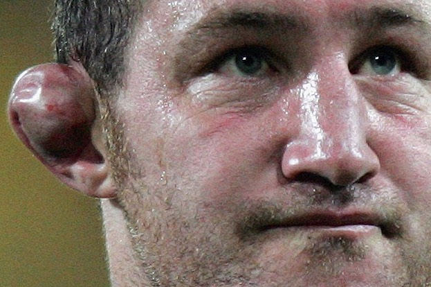 Qulaq qırma haqqında